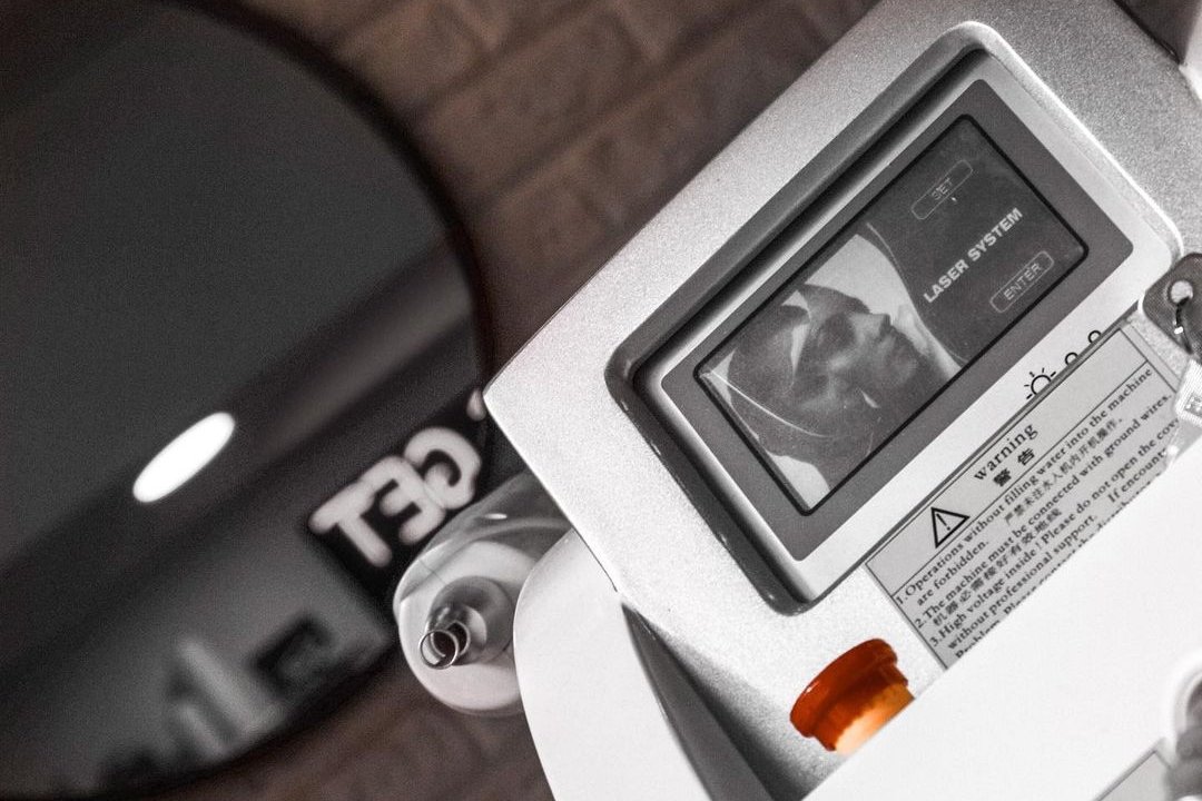 Laser tattoo removal in The Hague