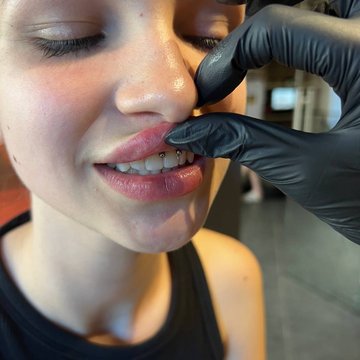 smiley piercing verzorgen