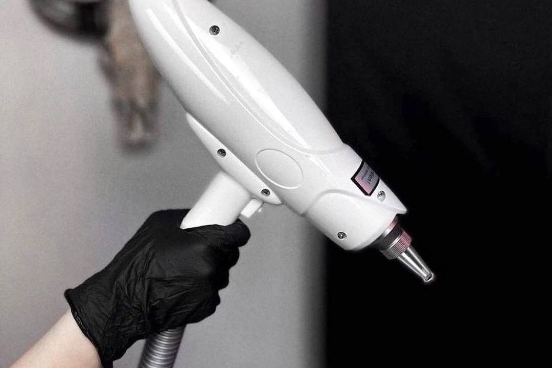 Laser tattoo removal in The Hague