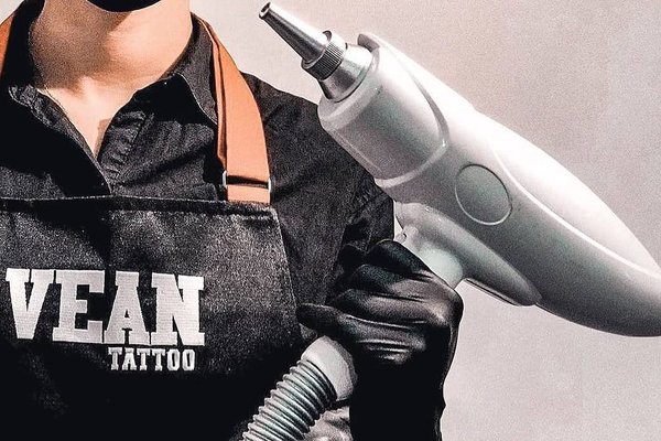 Laser tattoo removal in The Hague