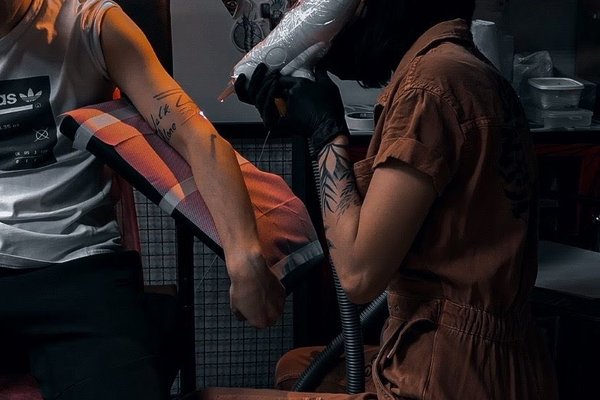 Laser Tattoo Verwijdering in Groningen