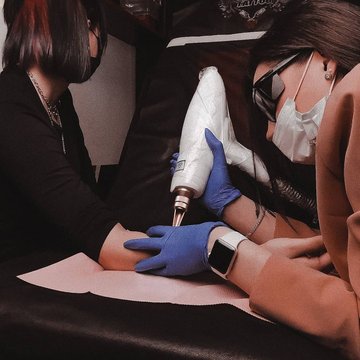 Laser tattoo verwijdering in Haarlem