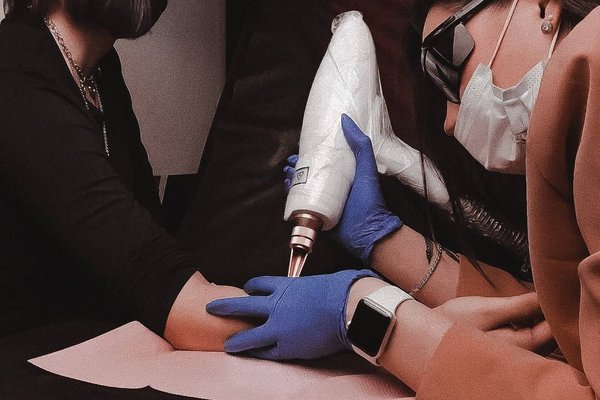 Laser tattoo removal in Haarlem