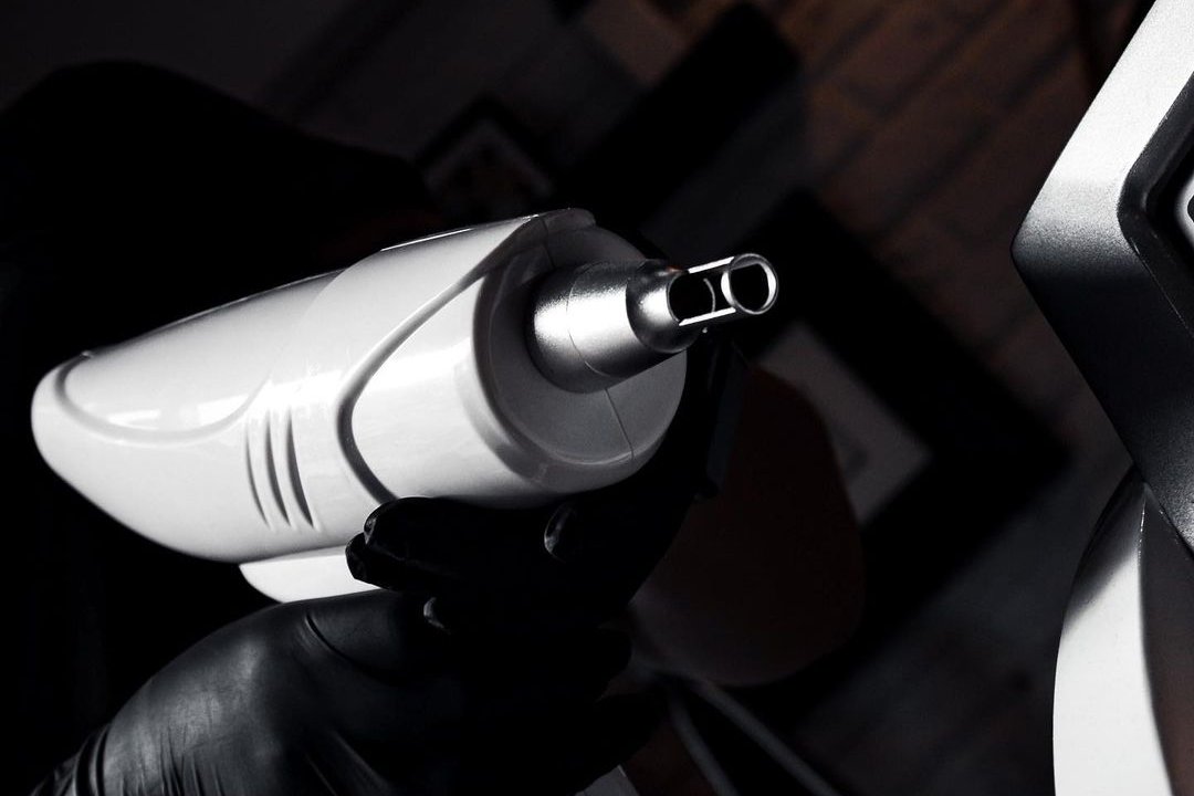 Tattoo Removal in Eindhoven