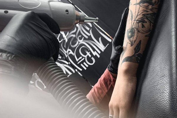 Tattoo Removal in Eindhoven