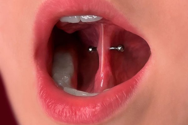 frenulum piercing