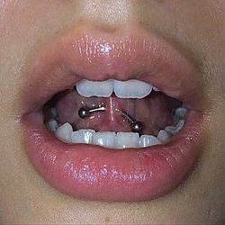 Frenulum Piercing