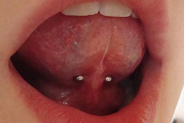 frenulum piercing