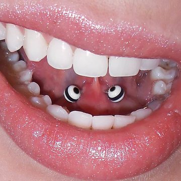 frenulum piercing