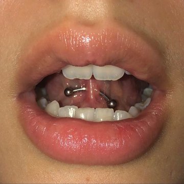 frenulum piercing