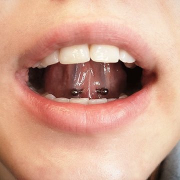 frenulum piercing