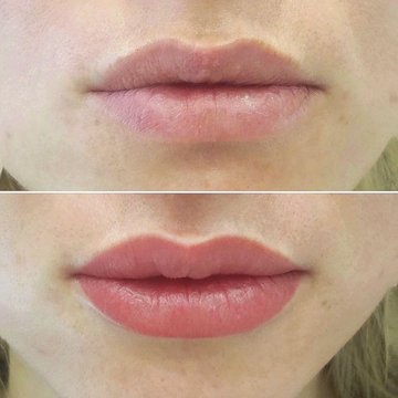 lippen tatoeëren nadelen